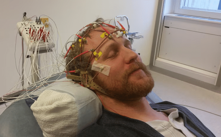 average Settlement for a Brain Injury